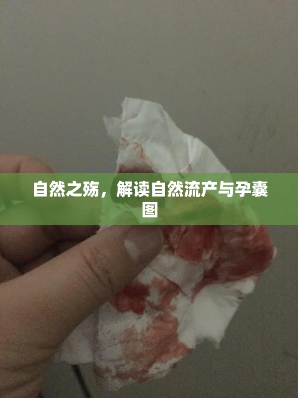 自然之殤，解讀自然流產(chǎn)與孕囊圖