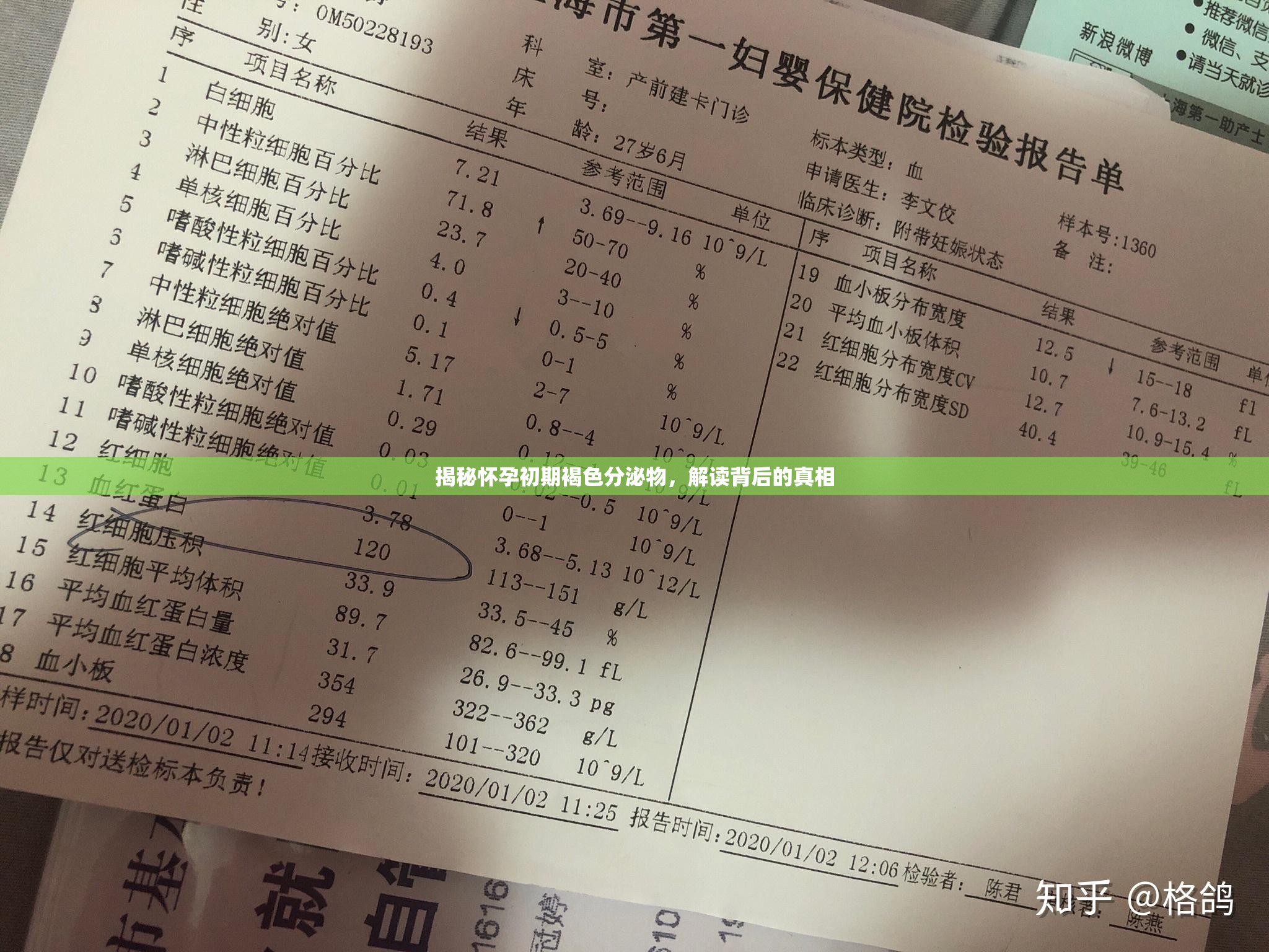 揭秘懷孕初期褐色分泌物，解讀背后的真相