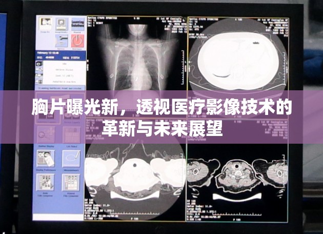 胸片曝光新，透視醫(yī)療影像技術(shù)的革新與未來(lái)展望