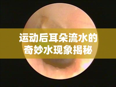 運(yùn)動(dòng)后耳朵流水的奇妙水現(xiàn)象揭秘