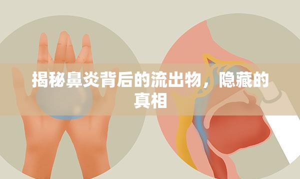 揭秘鼻炎背后的流出物，隱藏的真相