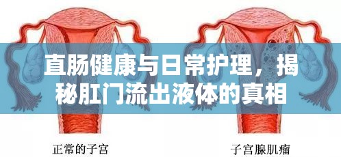 直腸健康與日常護理，揭秘肛門流出液體的真相