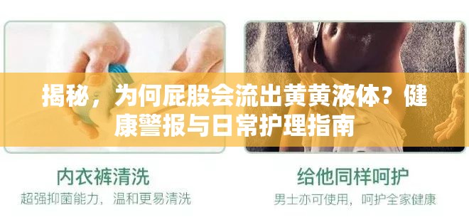 揭秘，為何屁股會流出黃黃液體？健康警報與日常護理指南