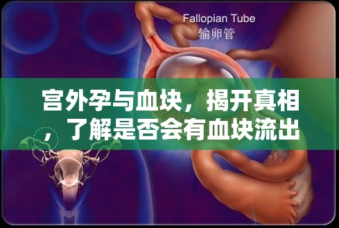 宮外孕與血塊，揭開真相，了解是否會(huì)有血塊流出