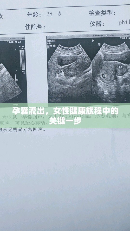 孕囊流出，女性健康旅程中的關(guān)鍵一步