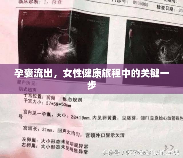 孕囊流出，女性健康旅程中的關(guān)鍵一步