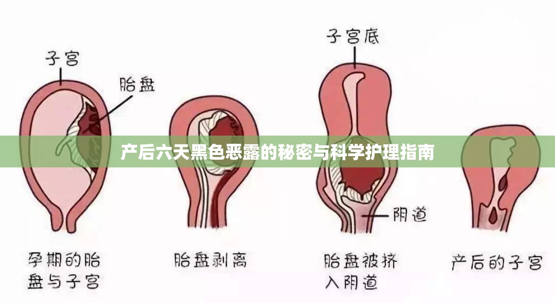 產(chǎn)后六天黑色惡露的秘密與科學(xué)護(hù)理指南