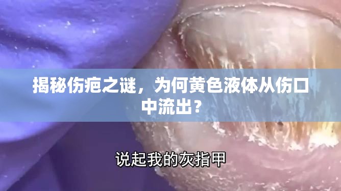 揭秘傷疤之謎，為何黃色液體從傷口中流出？
