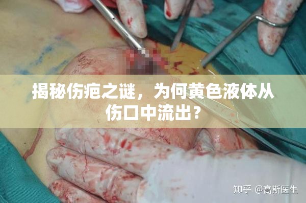 揭秘傷疤之謎，為何黃色液體從傷口中流出？