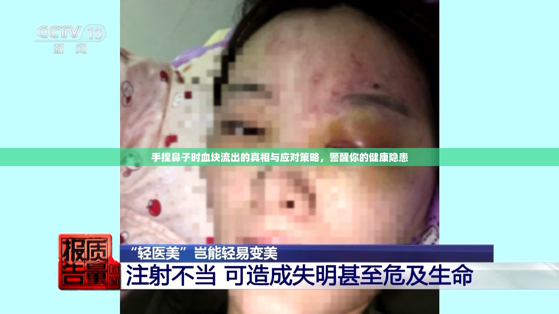 手捏鼻子時血塊流出的真相與應(yīng)對策略，警醒你的健康隱患