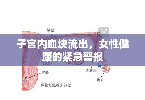 子宮內血塊流出，女性健康的緊急警報