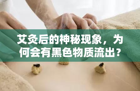 艾灸后的神秘現(xiàn)象，為何會有黑色物質(zhì)流出？
