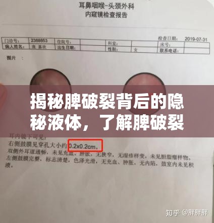 揭秘脾破裂背后的隱秘液體，了解脾破裂流出物的重要性與應(yīng)對措施