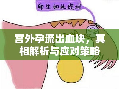 宮外孕流出血塊，真相解析與應(yīng)對策略
