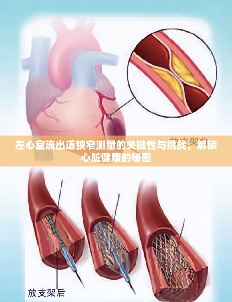 左心室流出道狹窄測量的關(guān)鍵性與挑戰(zhàn)，解鎖心臟健康的秘密