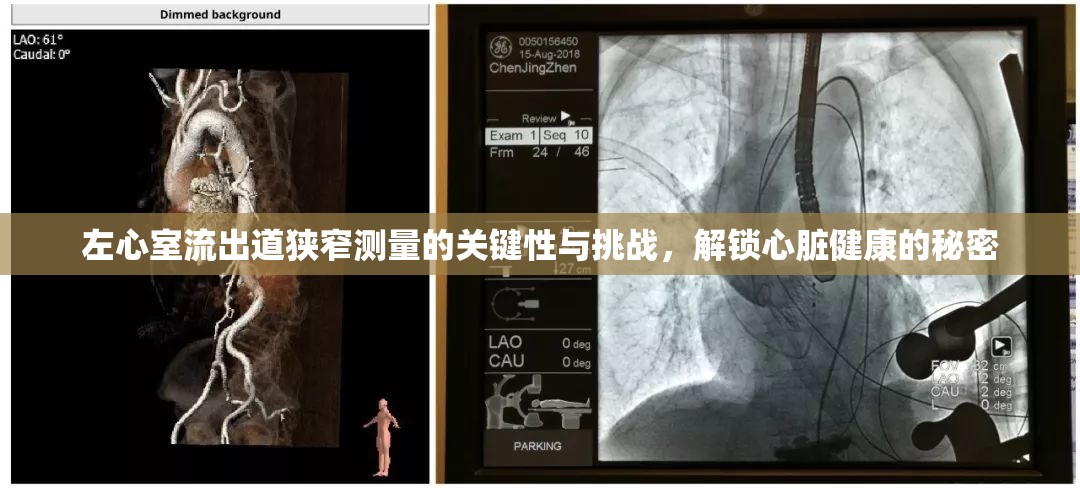 左心室流出道狹窄測量的關(guān)鍵性與挑戰(zhàn)，解鎖心臟健康的秘密