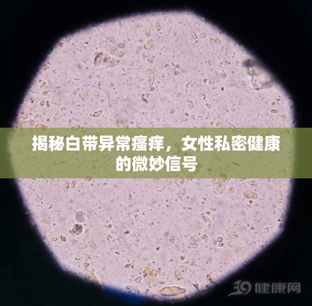 揭秘白帶異常瘙癢，女性私密健康的微妙信號