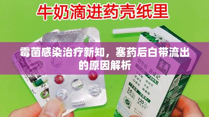霉菌感染治療新知，塞藥后白帶流出的原因解析