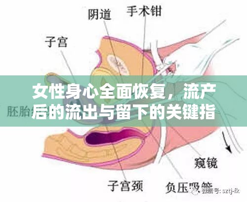 女性身心全面恢復(fù)，流產(chǎn)后的流出與留下的關(guān)鍵指南