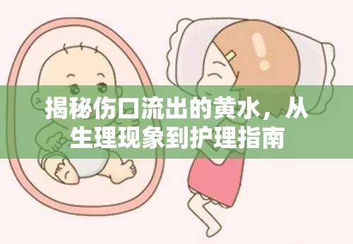 揭秘傷口流出的黃水，從生理現(xiàn)象到護(hù)理指南
