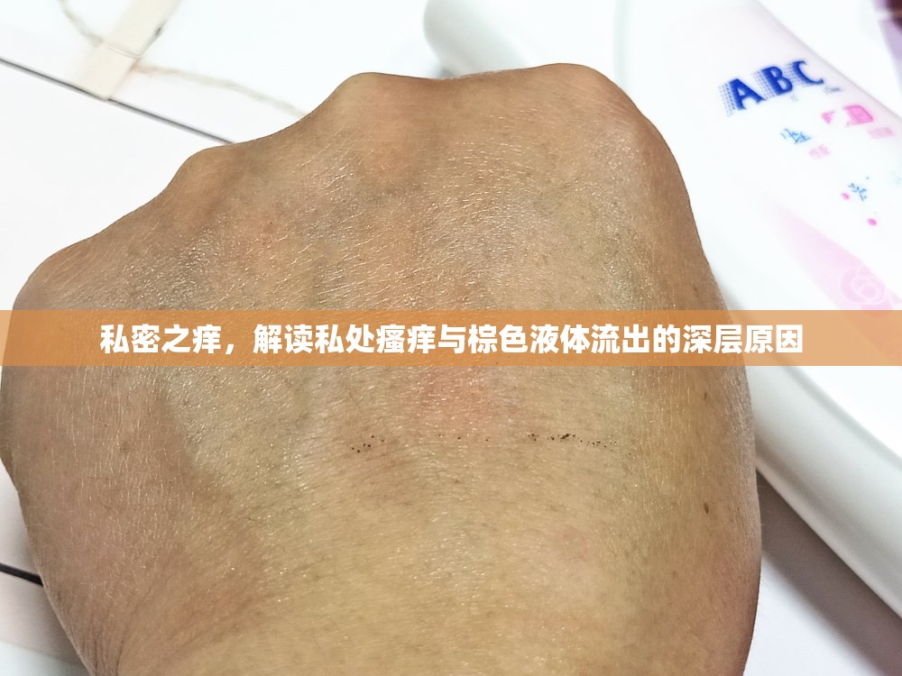 私密之癢，解讀私處瘙癢與棕色液體流出的深層原因