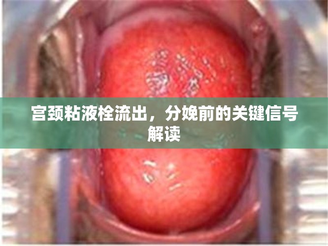 宮頸粘液栓流出，分娩前的關(guān)鍵信號解讀