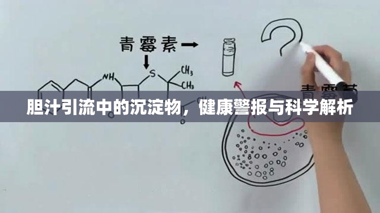 膽汁引流中的沉淀物，健康警報與科學解析
