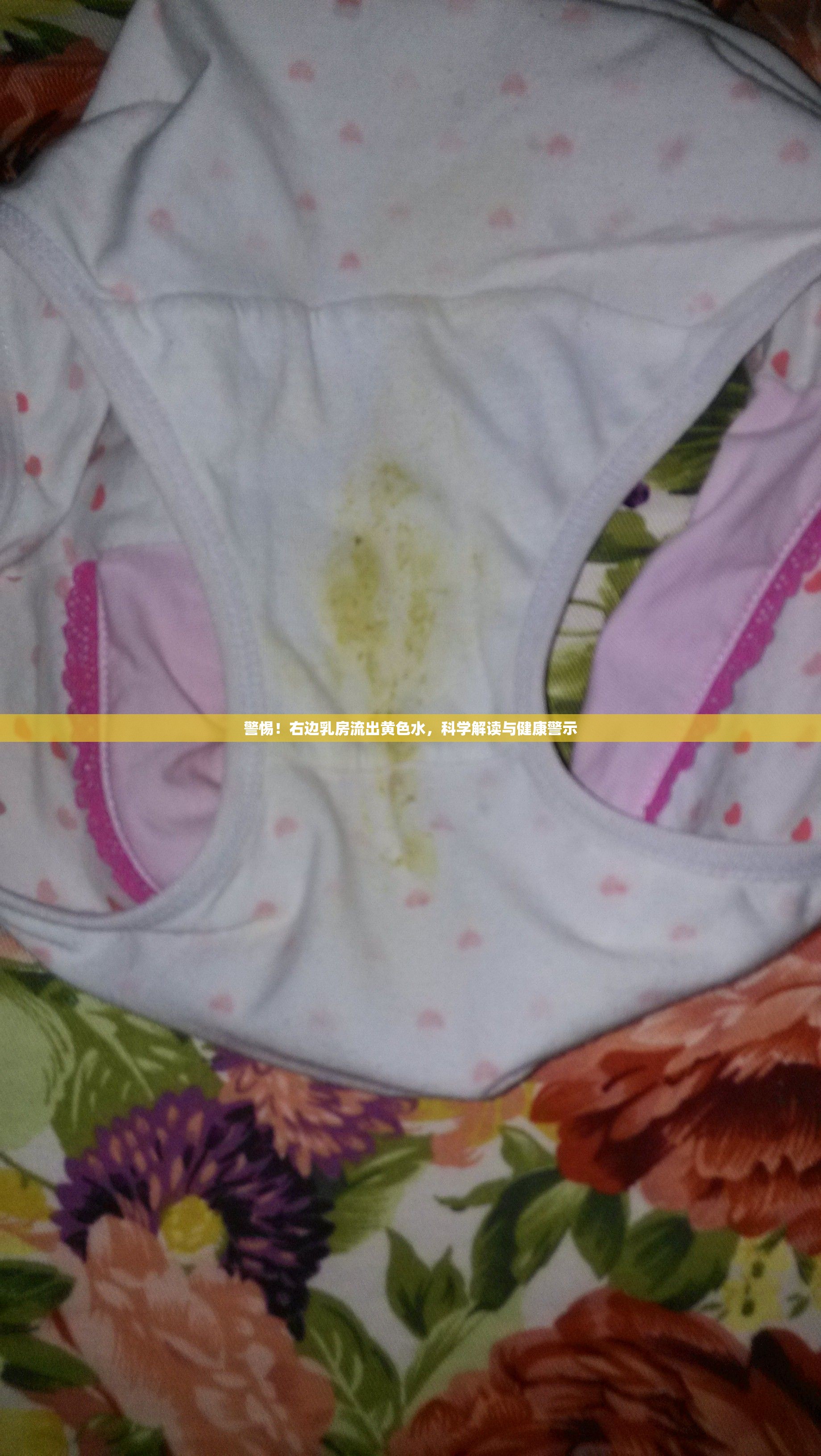 警惕！右邊乳房流出黃色水，科學(xué)解讀與健康警示
