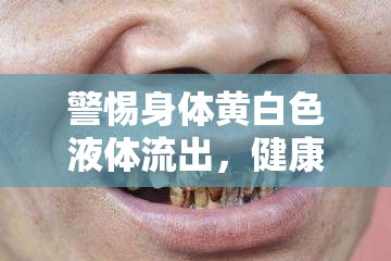 警惕身體黃白色液體流出，健康警鐘的信號