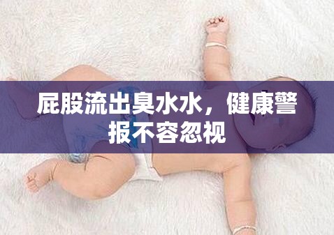 屁股流出臭水水，健康警報(bào)不容忽視