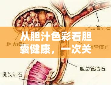 從膽汁色彩看膽囊健康，一次關于膽囊引流的深度解析