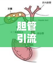 膽管引流中出現(xiàn)的絮狀物，健康警報(bào)的解讀與應(yīng)對