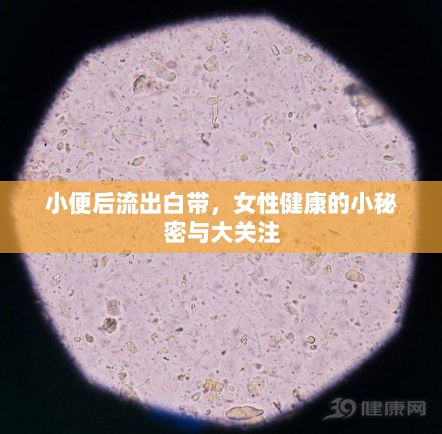 小便后流出白帶，女性健康的小秘密與大關注