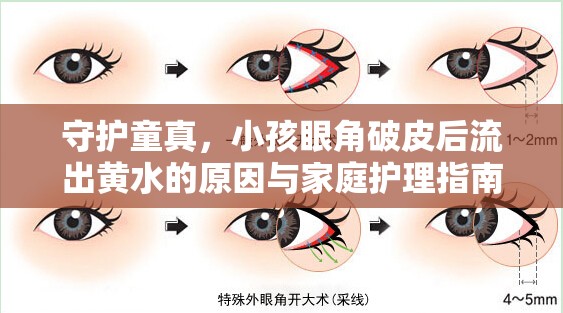 守護(hù)童真，小孩眼角破皮后流出黃水的原因與家庭護(hù)理指南