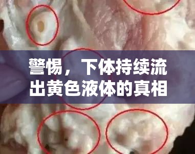 警惕，下體持續(xù)流出黃色液體的真相