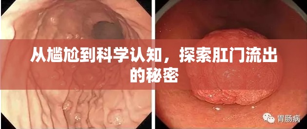 從尷尬到科學(xué)認(rèn)知，探索肛門流出的秘密