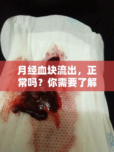 月經(jīng)血塊流出，正常嗎？你需要了解的真相