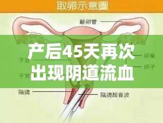 產(chǎn)后45天再次出現(xiàn)陰道流血，警惕異常情況