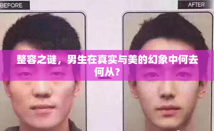 整容之謎，男生在真實(shí)與美的幻象中何去何從？