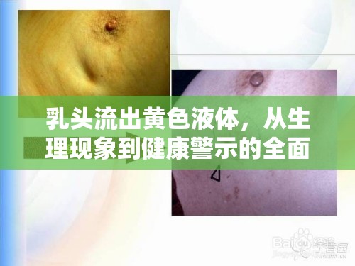 乳頭流出黃色液體，從生理現(xiàn)象到健康警示的全面解析