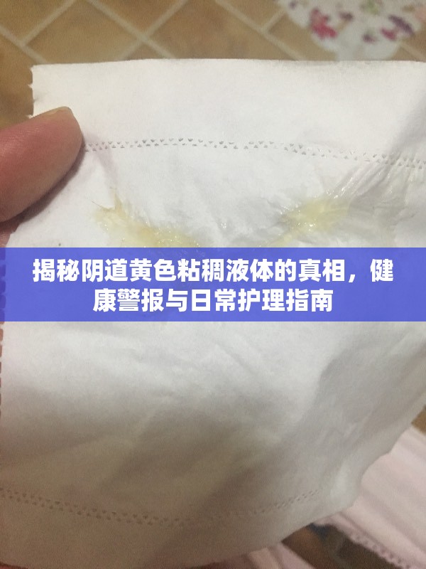 揭秘陰道黃色粘稠液體的真相，健康警報(bào)與日常護(hù)理指南