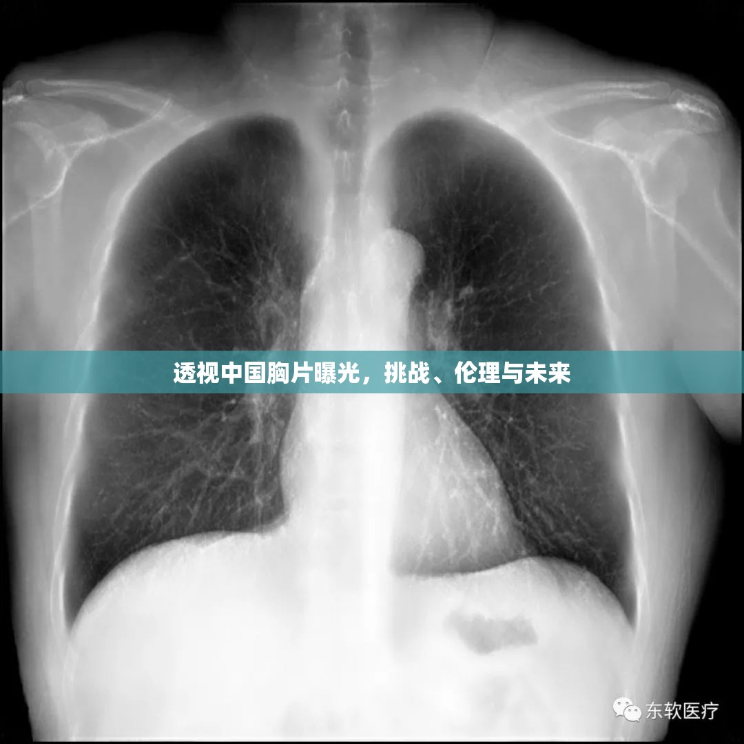 透視中國胸片曝光，挑戰(zhàn)、倫理與未來