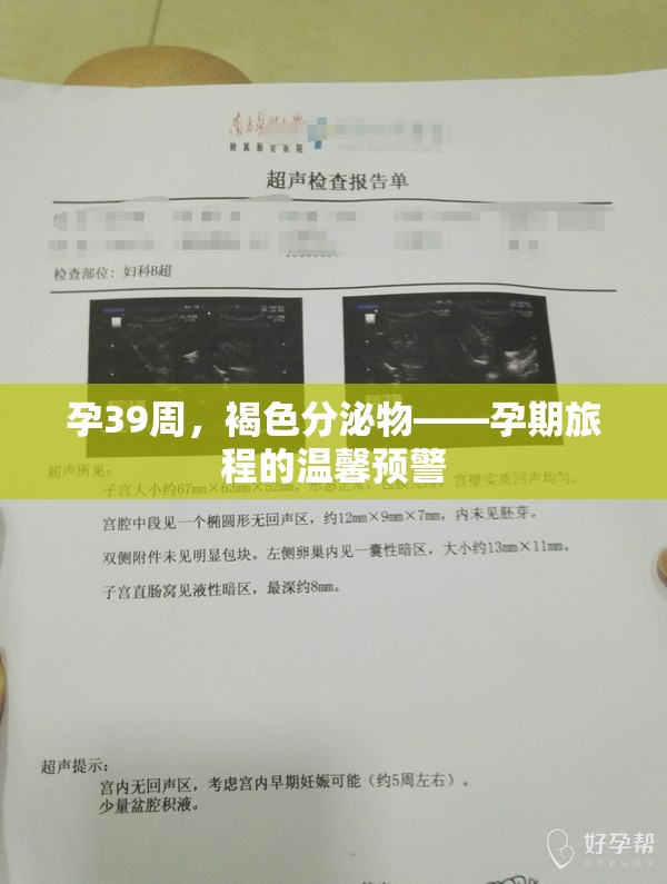 孕39周，褐色分泌物——孕期旅程的溫馨預(yù)警