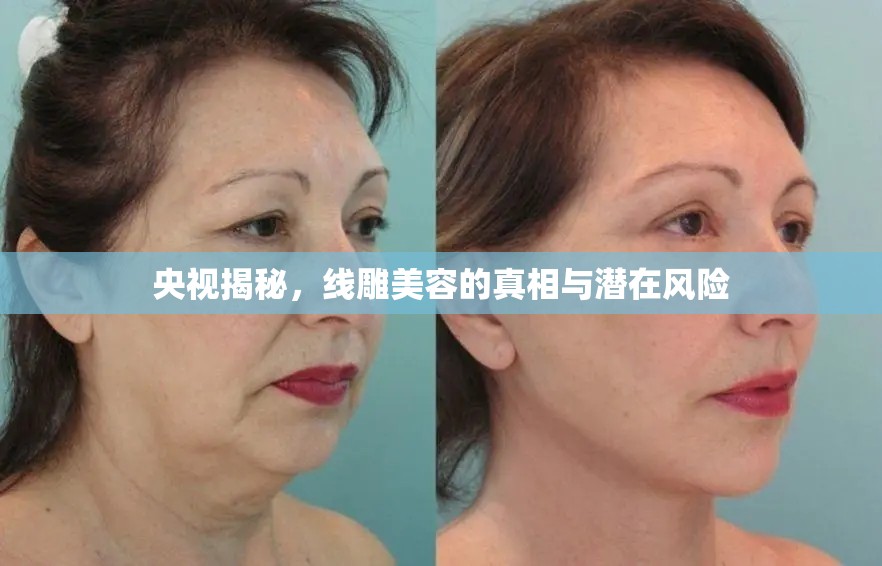 央視揭秘，線雕美容的真相與潛在風(fēng)險(xiǎn)