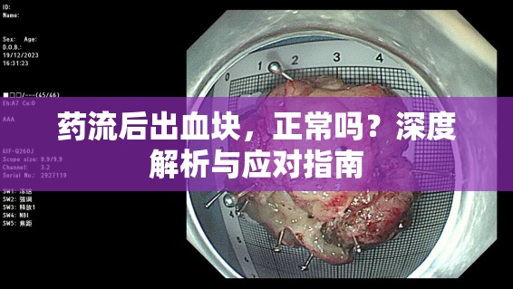 藥流后出血塊，正常嗎？深度解析與應(yīng)對指南