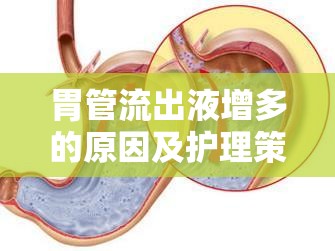 胃管流出液增多的原因及護理策略