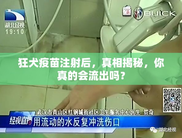 狂犬疫苗注射后，真相揭秘，你真的會流出嗎？