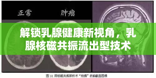 解鎖乳腺健康新視角，乳腺核磁共振流出型技術(shù)