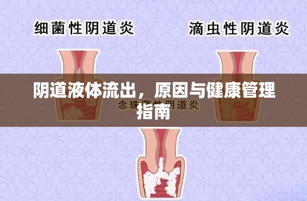 陰道液體流出，原因與健康管理指南