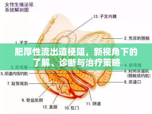 肥厚性流出道梗阻，新視角下的了解、診斷與治療策略